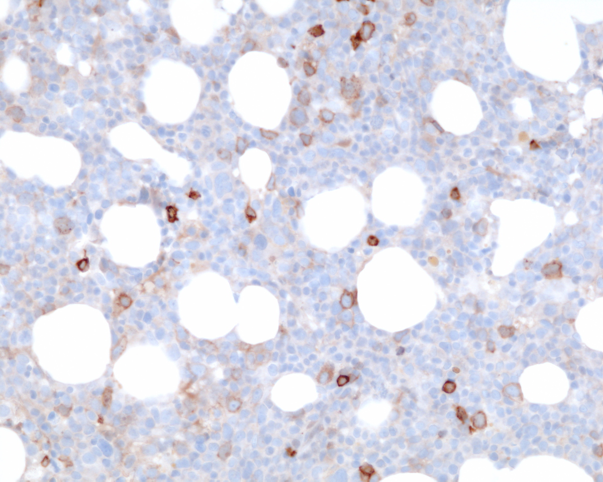 Immunohistochemistry CD117